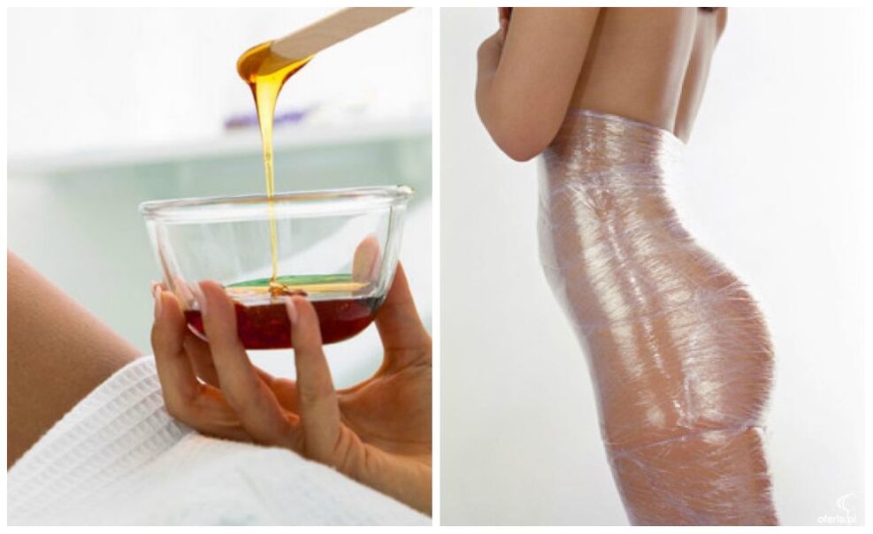 împachetări corporale pentru pierderea în greutate